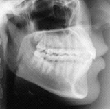 Radiologia Odontológica no Centro de Salvador